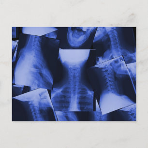 X-straling - elektromagnetisch blauw briefkaart