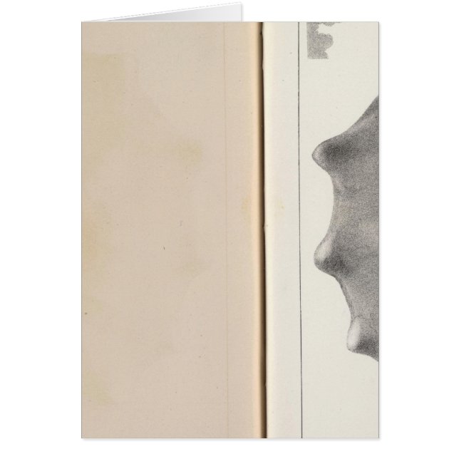 XIX Crétacé (Devant)