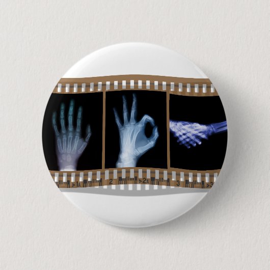 XRAY SIGN TAAL FILM - HAND OK HANDSHAKE RONDE BUTTON 5,7 CM (Voorkant)