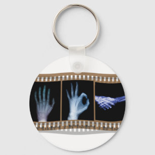 XRAY SIGN TAAL FILM - HAND OK HANDSHAKE SLEUTELHANGER
