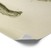 Zenuwstelselaandoeningen  anatomische voorzijde poster (Hoek)