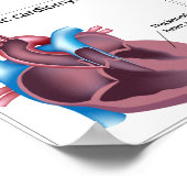 Ziekten van het Poster van de hartspier (Hoek)