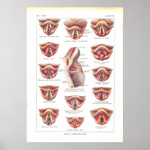 Ziekten van Larynx Anatomy Poster French