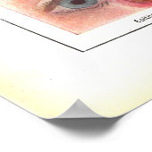 Ziekten van Oog-anatomie Poster Frans (Hoek)