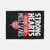 Zipper Club Lid Open Heart Surgery Survivor Fleece Deken (Voorkant (Horizontaal))