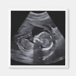 Zwanger Sonogram Foto Tijdloos Keepsake plezier Magneet