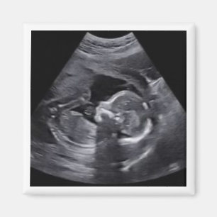 Zwanger Sonogram Foto Tijdloos Keepsake plezier Magneet