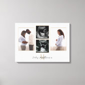Zwangerschap 4 foto Collage Monogram Initiaal Canvas Afdruk (Voorkant)