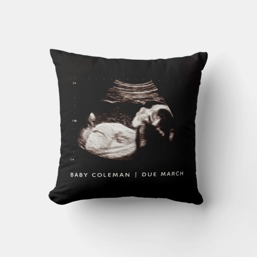 Zwangerschap Aankondiging Baby Sonogram Foto Kussen (Voorkant)