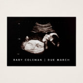 Zwangerschap Aankondiging Sonogram Mini Card Pack (Voorkant)