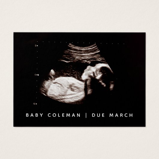 Zwangerschap Aankondiging Sonogram Mini Card Pack (Voorkant)