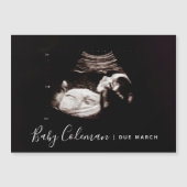 Zwangerschap Aankondiging Sonogram Naam Magnet (Voorkant)