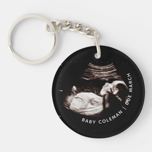 Zwangerschap Aankondiging Sonogram New Arrival Fot Sleutelhanger (Voorkant)