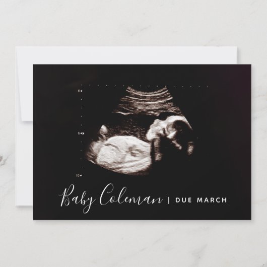 Zwangerschap Aankondiging Sonogram Script Name Car (Voorkant)