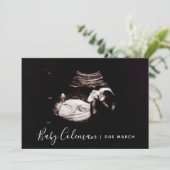 Zwangerschap Aankondiging Sonogram Script Name Car (Staand voorkant)