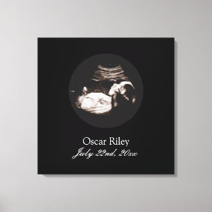 Zwangerschap Baby Sonogram Echografie Foto kinderk Canvas Afdruk