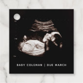 Zwangerschap Baby Sonogram Ultrageluid Foto Bedankjes Labels (Voorkant)