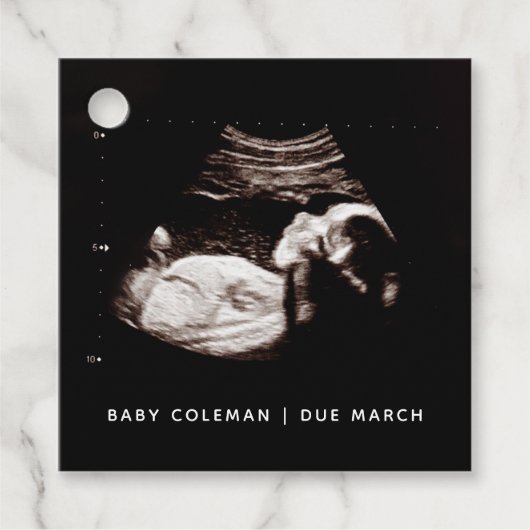 Zwangerschap Baby Sonogram Ultrageluid Foto Bedankjes Labels (Voorkant)
