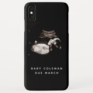 Zwangerschap Baby Sonogram Ultrageluid Foto iPhone XS Max Hoesje