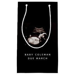 Zwangerschap Baby Sonogram Ultrageluid Foto Klein Cadeauzakje