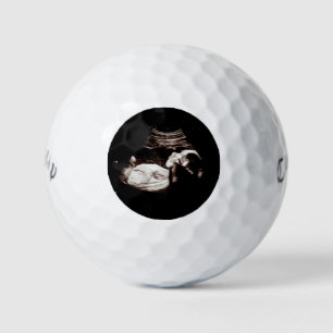 Zwangerschap Baby Sonogram Ultrageluid Foto Mannel Golfballen