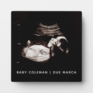 Zwangerschap Baby Sonogram Ultrasound Foto Nieuw m Fotoplaat