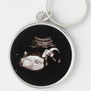 Zwangerschap Baby Sonogram Ultrasound Foto Nieuw m Sleutelhanger