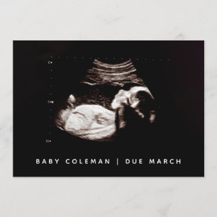 Zwangerschap Baby Sonogram Ultrasound fotokaart Kaart