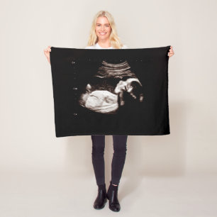 Zwangerschap Baby Ultrasound Sonogram Foto Fleece Deken