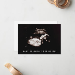 Zwangerschap Onthul Baby Echografie Sonogram Foto Notitiekaartje