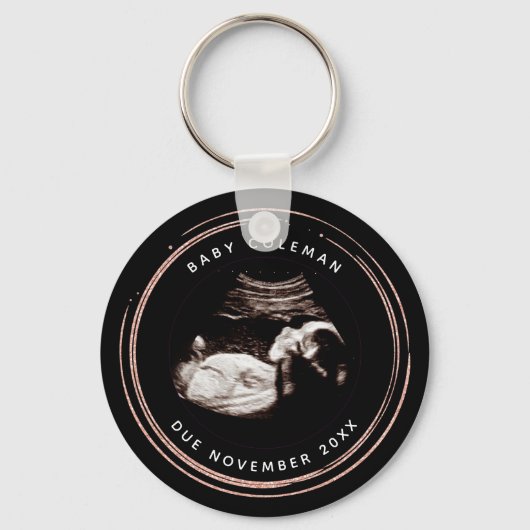 Zwangerschap Roze Glitter Sonogram Ultrageluid Fot Sleutelhanger (Voorkant)