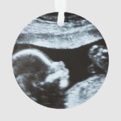 Zwangerschap Verlies Miskraam Kerstversiering Ornament (achterkant)